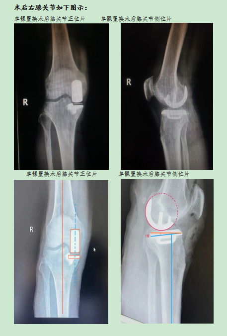 1681171964576140.png 微信圖片_20230411080859.png