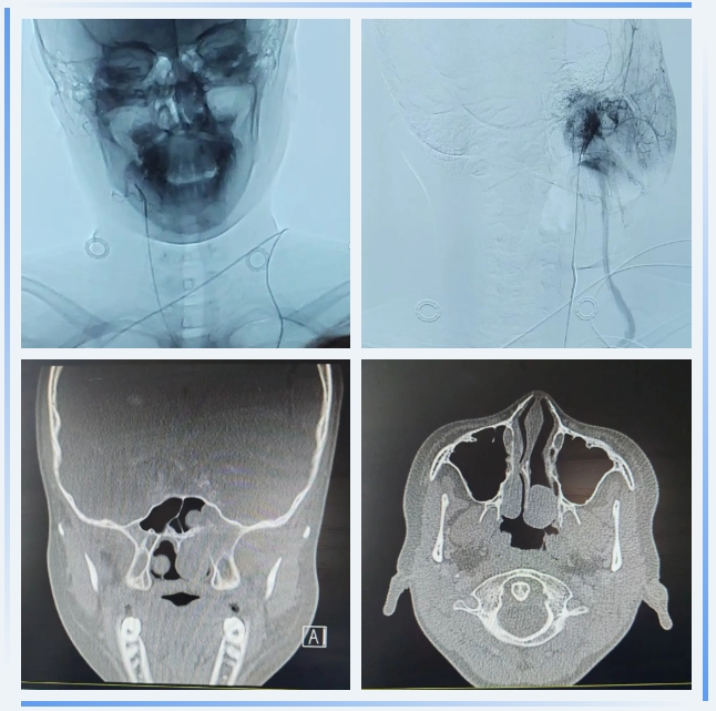 1742346133236377.png 微信截图_20250319090111.png