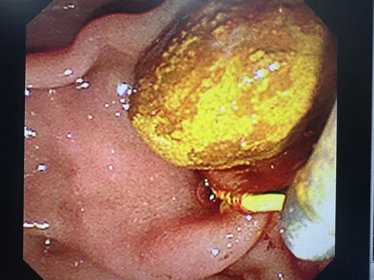 1745805760132997.jpg 微信图片_20250428100054.jpg