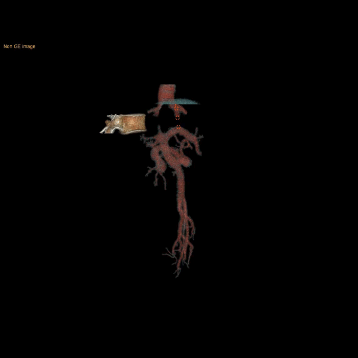 640.png